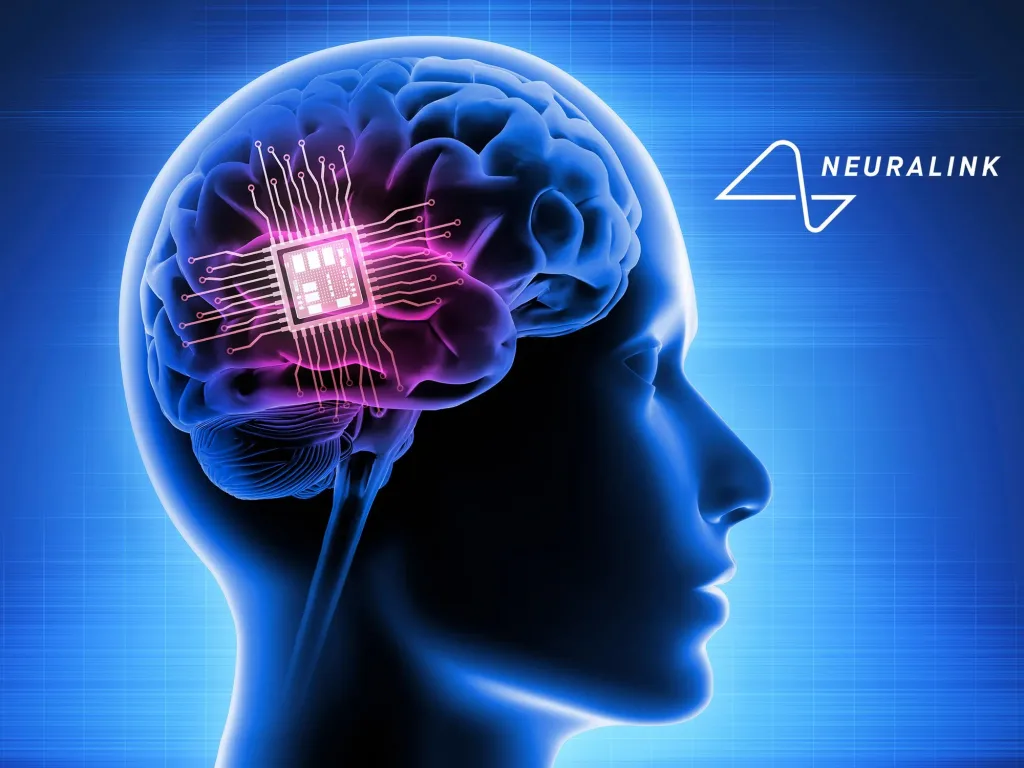 The Rise of "Neuronal Cyberattacks" via Shared Implants