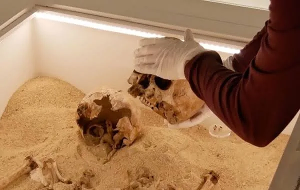 Genetic Mapping of Medieval Graves Reveals Surprising Social Stigma Patterns in Ancient Diseases